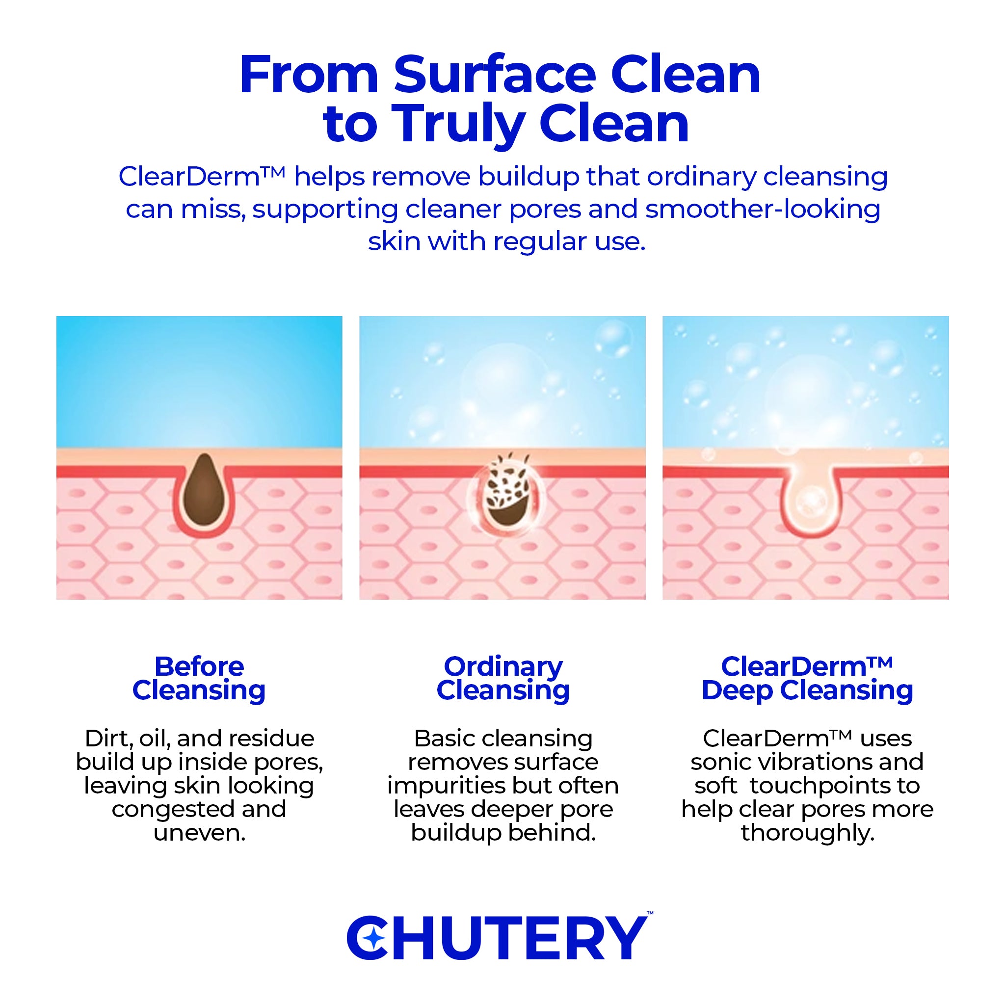 Chutery ClearDerm™ Sonic Cleanser
